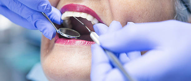 Best Emergency Dental Care for Abscessed Tooth in Clarkston, GA